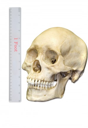 Large Skull